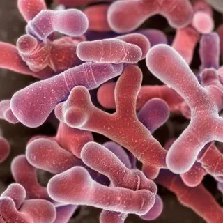Bifidobacterium longum BB536